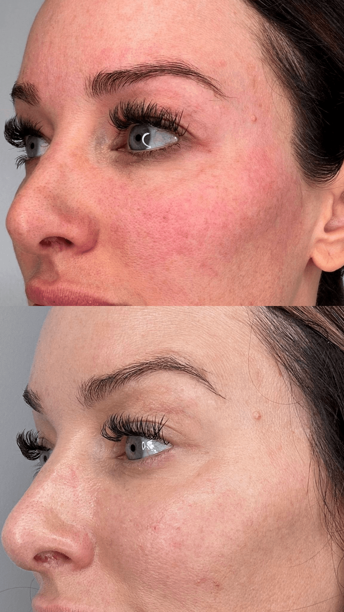 AgeJET before and after close-up skin clarity and texture